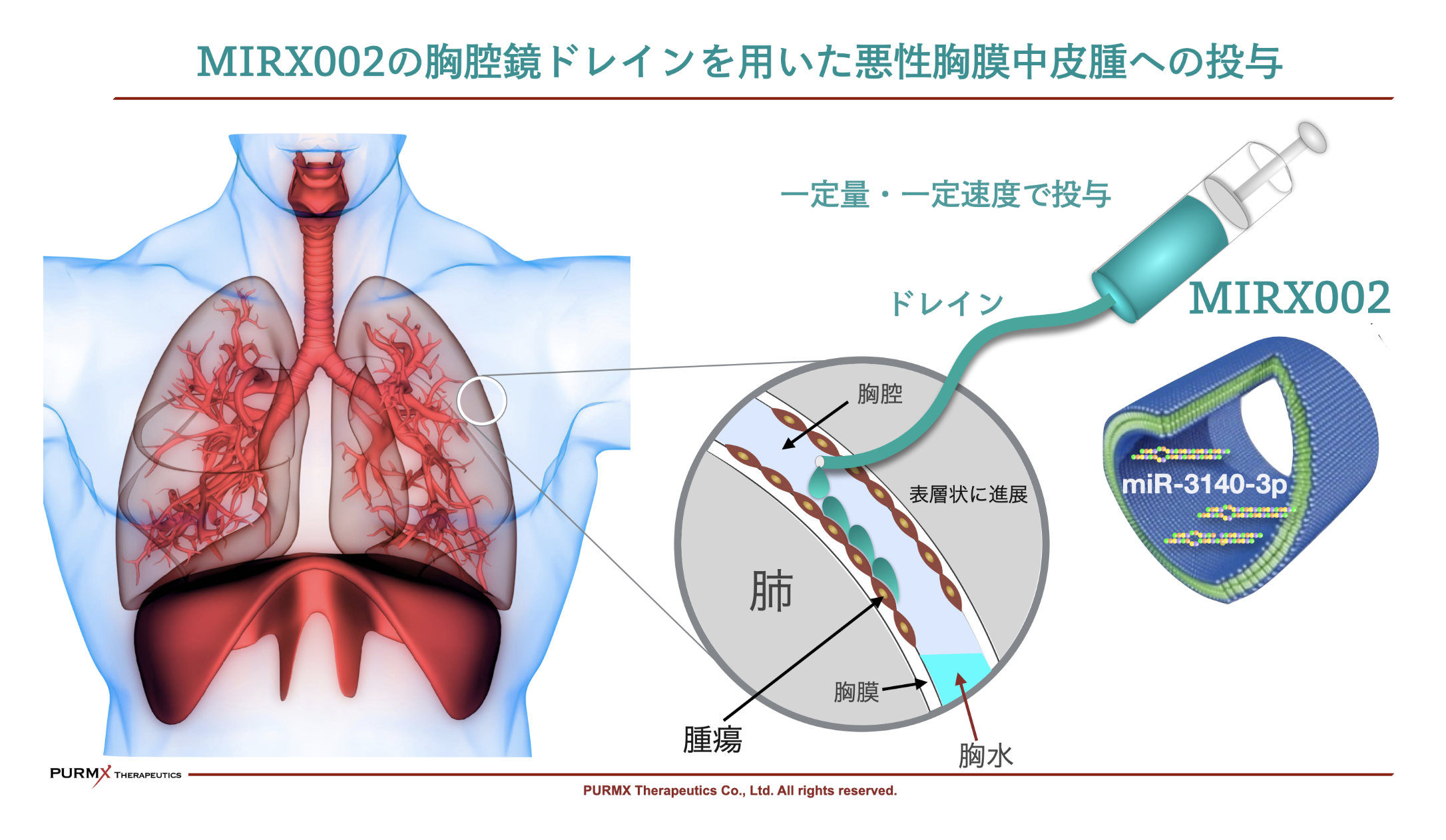 URMX Therapeuticsが実施中の治験